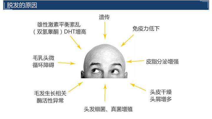 导致脱发的病因具体有哪些